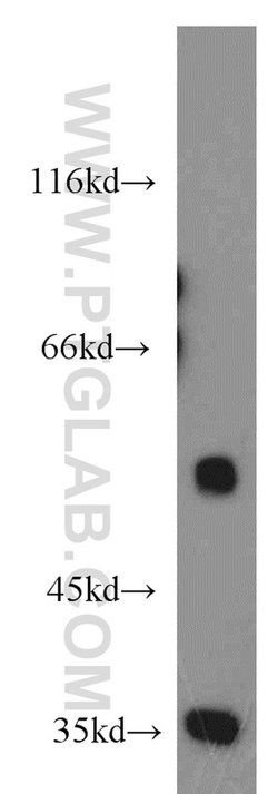 CDK8 Rabbit anti-Human, Mouse, Polyclonal, Proteintech 150 &mu;L; Unconjugated:Antibodies,