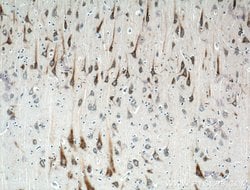 UNC5A Rabbit anti-Human, Mouse, Rat, Polyclonal, Proteintech 150 &mu;L;
