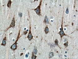 UNC5A Rabbit anti-Human, Mouse, Rat, Polyclonal, Proteintech 150 &mu;L;