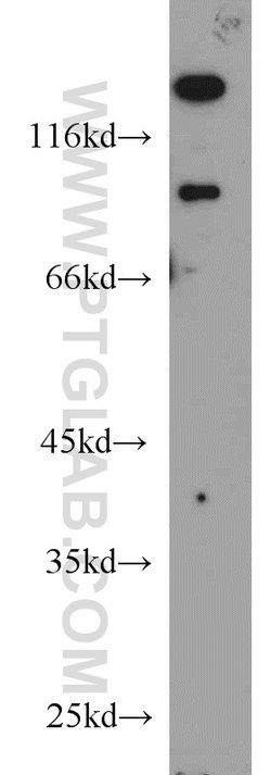 UNC5A Rabbit anti-Human, Mouse, Rat, Polyclonal, Proteintech 150 &mu;L;