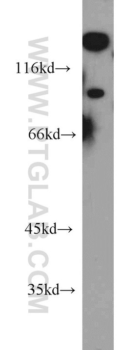 UNC5A Rabbit anti-Human, Mouse, Rat, Polyclonal, Proteintech 150 &mu;L;