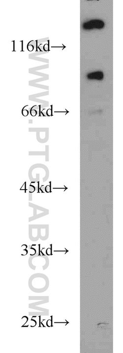 UNC5A Rabbit anti-Human, Mouse, Rat, Polyclonal, Proteintech 150 &mu;L;