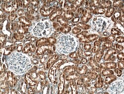 SYTL3 Rabbit anti-Human, Mouse, Rat, Polyclonal, Proteintech 150 &mu;L;