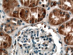 SYTL3 Rabbit anti-Human, Mouse, Rat, Polyclonal, Proteintech 150 &mu;L;
