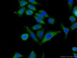 ARHGAP27 Rabbit anti-Human, Polyclonal, Proteintech 150 &mu;L | Buy Online | Proteintech Group Inc | Fisher Scientific