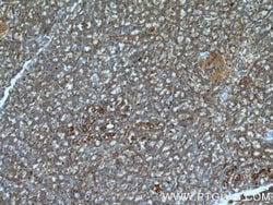 ARHGAP27 Rabbit anti-Human, Polyclonal, Proteintech 150 &mu;L | Buy Online | Proteintech Group Inc | Fisher Scientific