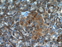 ARHGAP27 Rabbit anti-Human, Polyclonal, Proteintech 150 &mu;L | Buy Online | Proteintech Group Inc | Fisher Scientific