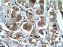 ARHGAP27 Rabbit anti-Human, Polyclonal, Proteintech 150 &mu;L | Buy Online | Proteintech Group Inc | Fisher Scientific