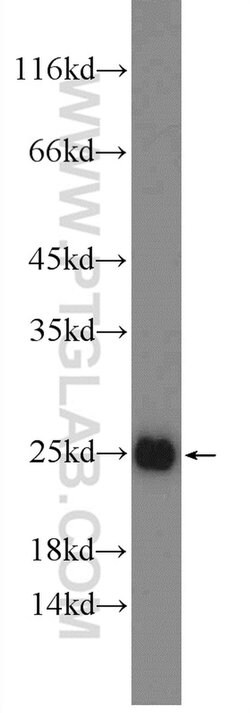 PPP1R14D Rabbit anti-Human, Mouse, Polyclonal, Proteintech:Antibodies:Primary