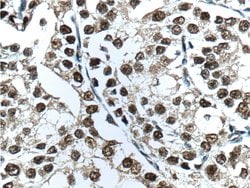androgen receptor Rabbit anti-Human, Mouse, Rat, Polyclonal, Proteintech:Antibodies:Primary