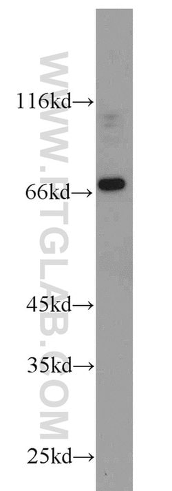 androgen receptor Rabbit anti-Human, Mouse, Rat, Polyclonal, Proteintech:Antibodies:Primary