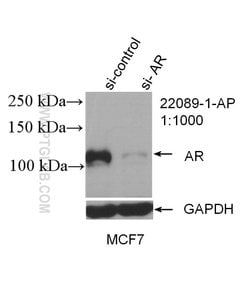 androgen receptor Rabbit anti-Human, Mouse, Rat, Polyclonal, Proteintech:Antibodies:Primary