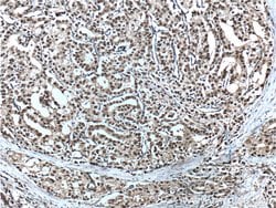 androgen receptor Rabbit anti-Human, Mouse, Rat, Polyclonal, Proteintech:Antibodies:Primary