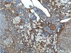 androgen receptor Rabbit anti-Human, Mouse, Rat, Polyclonal, Proteintech:Antibodies:Primary
