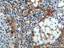 androgen receptor Rabbit anti-Human, Mouse, Rat, Polyclonal, Proteintech:Antibodies:Primary