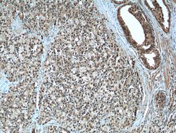 androgen receptor Rabbit anti-Human, Mouse, Rat, Polyclonal, Proteintech:Antibodies:Primary