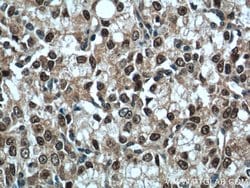 androgen receptor Rabbit anti-Human, Mouse, Rat, Polyclonal, Proteintech:Antibodies:Primary