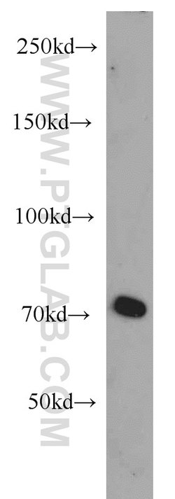 androgen receptor Rabbit anti-Human, Mouse, Rat, Polyclonal, Proteintech:Antibodies:Primary