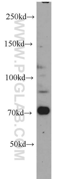 androgen receptor Rabbit anti-Human, Mouse, Rat, Polyclonal, Proteintech:Antibodies:Primary