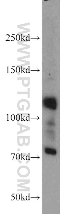 androgen receptor Rabbit anti-Human, Mouse, Rat, Polyclonal, Proteintech:Antibodies:Primary