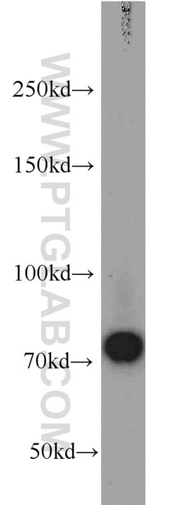 androgen receptor Rabbit anti-Human, Mouse, Rat, Polyclonal, Proteintech:Antibodies:Primary