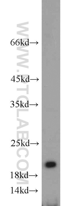 ISG20 Rabbit anti-Human, Mouse, Rat, Polyclonal, Proteintech:Antibodies:Primary