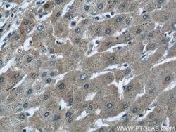 ALDH1A1 Rabbit anti-Human, Mouse, Rat, Polyclonal, Proteintech 20 &mu;L;