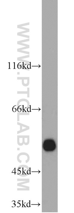 ALDH1A1 Rabbit anti-Human, Mouse, Rat, Polyclonal, Proteintech 20 &mu;L;