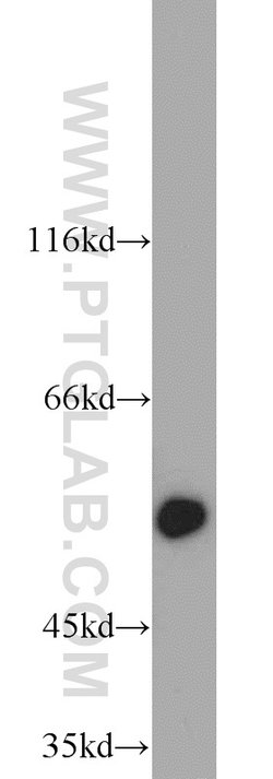 ALDH1A1 Rabbit anti-Human, Mouse, Rat, Polyclonal, Proteintech 20 &mu;L;