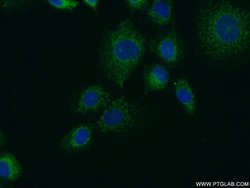 FUT4 Rabbit anti-Human, Polyclonal, Proteintech 150 &mu;L; Unconjugated:Antibodies,