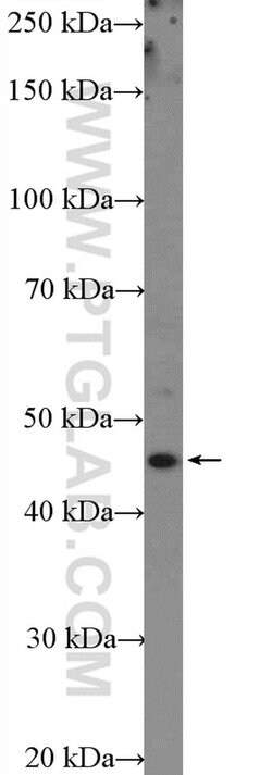 FUT4 Rabbit anti-Human, Polyclonal, Proteintech 150 &mu;L; Unconjugated:Antibodies,