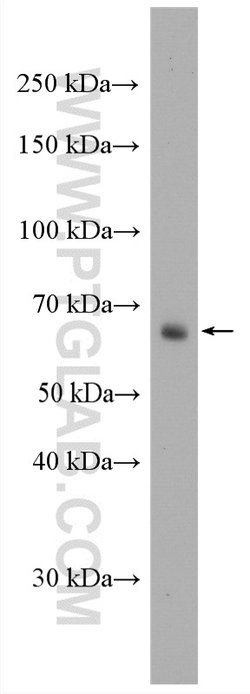 FUT4 Rabbit anti-Human, Polyclonal, Proteintech 150 &mu;L; Unconjugated:Antibodies,