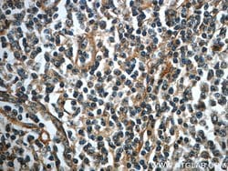 Integrin alpha-1 Rabbit anti-Human, Polyclonal, Proteintech 150 &mu;L;