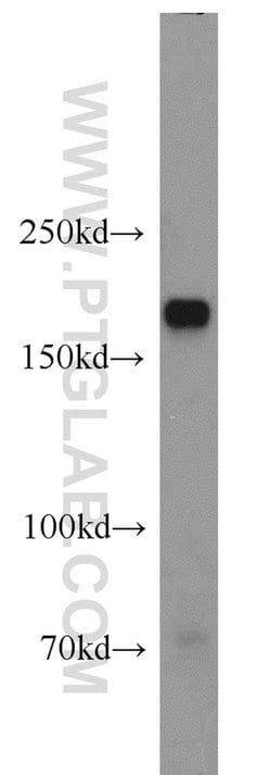 Integrin alpha-1 Rabbit anti-Human, Polyclonal, Proteintech 150 &mu;L;