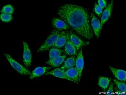 PYCR1 Rabbit anti-Human, Mouse, Rat, Polyclonal, Proteintech:Anticorps:Anticorps