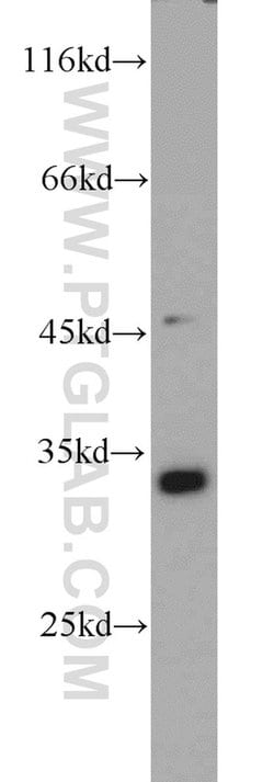 PYCR1 Rabbit anti-Human, Mouse, Rat, Polyclonal, Proteintech