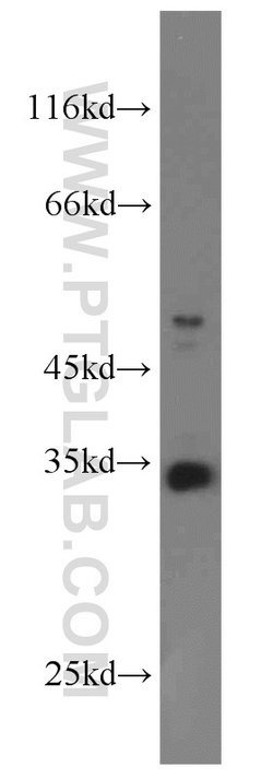 PYCR1 Rabbit anti-Human, Mouse, Rat, Polyclonal, Proteintech:Anticorps:Anticorps