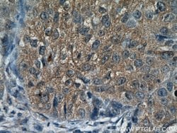 C3orf10 Rabbit anti-Human, Mouse, Rat, Polyclonal, Proteintech 20 &mu;L;