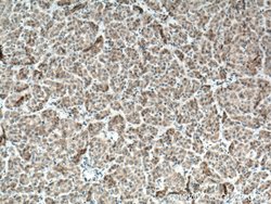 BMP3 Rabbit anti-Human, Polyclonal, Proteintech 20 &mu;L; Unconjugated:Anticuerpos