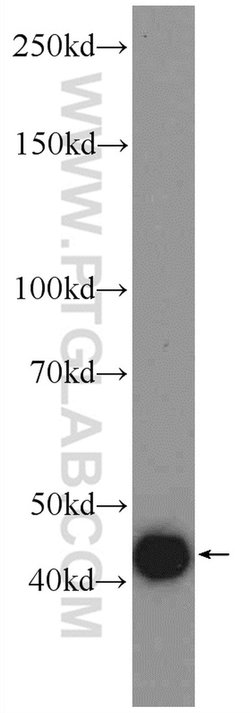 BMP3 Rabbit anti-Human, Polyclonal, Proteintech 20 &mu;L; Unconjugated:Anticuerpos