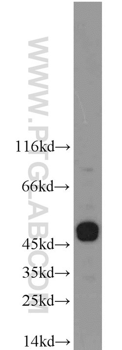 CHRNB4 Rabbit anti-Human, Mouse, Polyclonal, Proteintech:Antibodies:Primary