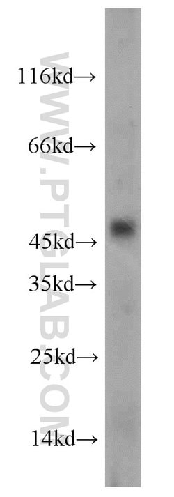 CHRNB4 Rabbit anti-Human, Mouse, Polyclonal, Proteintech:Antibodies:Primary