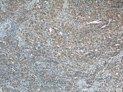 ZAP70 Rabbit anti-Human, Mouse, Polyclonal, Proteintech 20 &mu;L; Unconjugated:Antibodies,