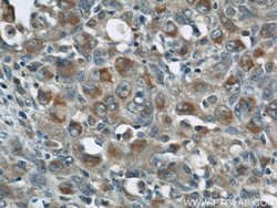 ZAP70 Rabbit anti-Human, Mouse, Polyclonal, Proteintech 20 &mu;L; Unconjugated:Antibodies,