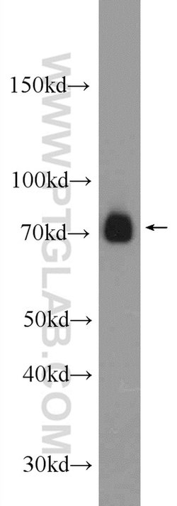ZAP70 Rabbit anti-Human, Mouse, Polyclonal, Proteintech 20 &mu;L; Unconjugated:Antibodies,