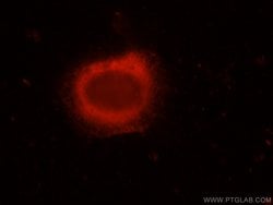 ERC1 Rabbit anti-Human, Polyclonal, Proteintech 150 &mu;L; Unconjugated:Antibodies,