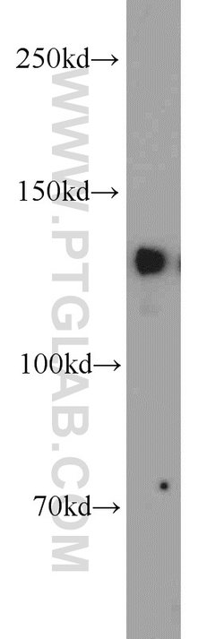 ERC1 Rabbit anti-Human, Polyclonal, Proteintech 150 &mu;L; Unconjugated:Antibodies,