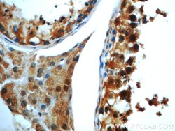 TMF1 Rabbit anti-Human, Mouse, Rat, Polyclonal, Proteintech:Antibodies:Primary