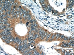 TMF1 Rabbit anti-Human, Mouse, Rat, Polyclonal, Proteintech:Antibodies:Primary