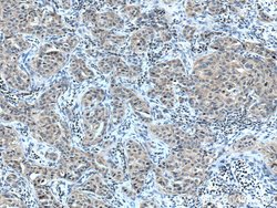 ACP1 Rabbit anti-Human, Mouse, Polyclonal, Proteintech 20 &mu;L; Unconjugated:Antibodies,